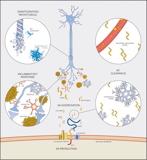 The amyloid cascade hypothesis for Alzheimer's .